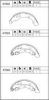 ASIMCO K7003 Brake Shoe Set
